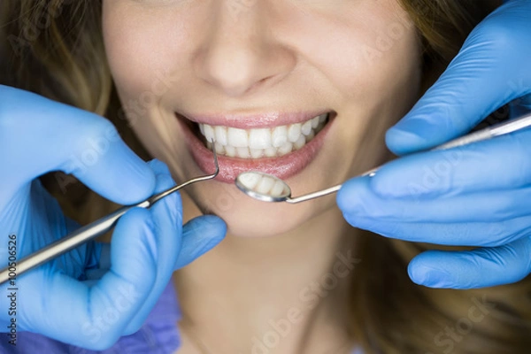 Obraz Dentist examining a patient's teeth in the dentist.