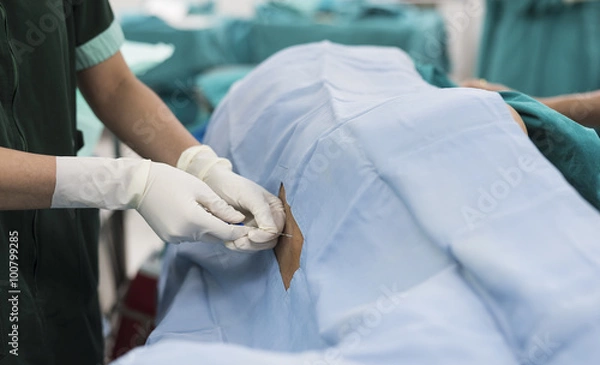 Obraz epidural nerve block