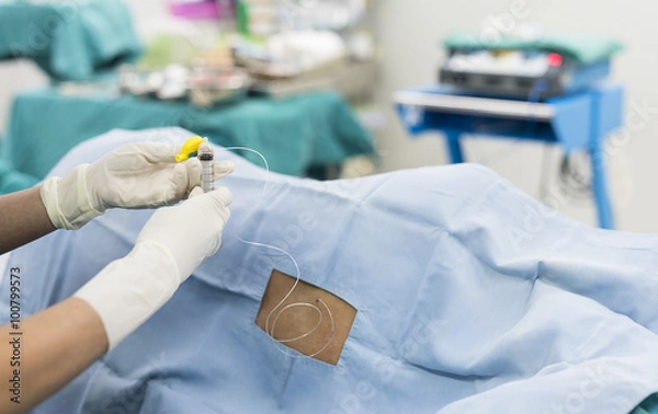 Obraz epidural nerve block