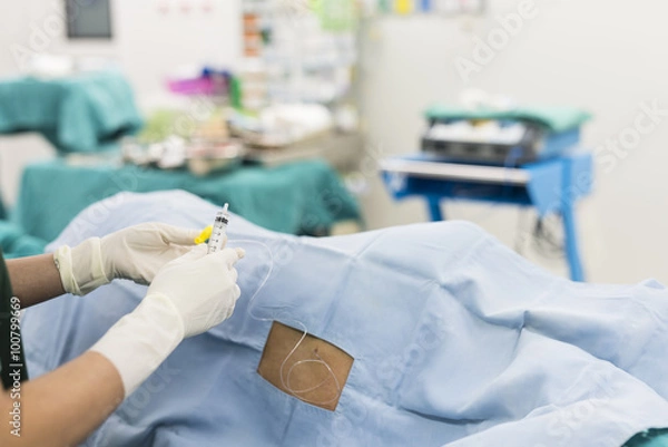 Fototapeta epidural nerve block