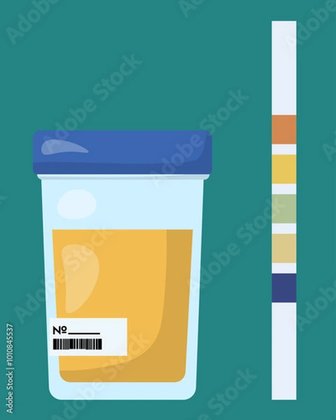 Fototapeta Ketone test, paper strip with colored squares for testing acetone levels and a closed container with a urine sample