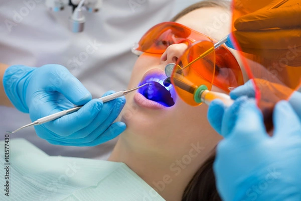 Obraz Tooth filling ultraviolet lamp