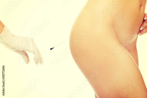 Fototapeta Injection before surgery on a woman's bottom