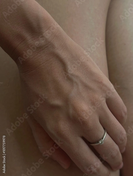 Obraz Sensitive skin
