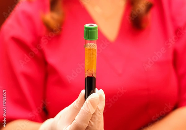 Obraz Blood specimen after being centrifuged