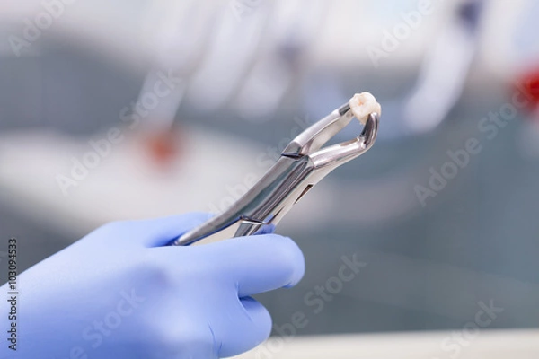 Obraz Wyrywanie zęba