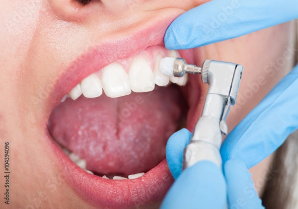 Obraz Zbliżenie pacjentki o badanie zębów