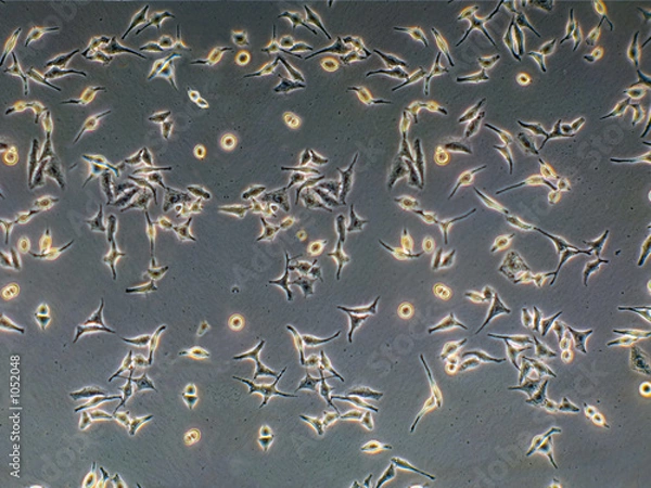Obraz cervical cancer cells