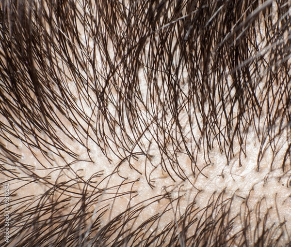Obraz Closeup head with hair and scalp