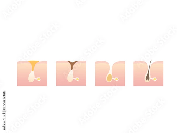 Obraz 毛穴のイラスト