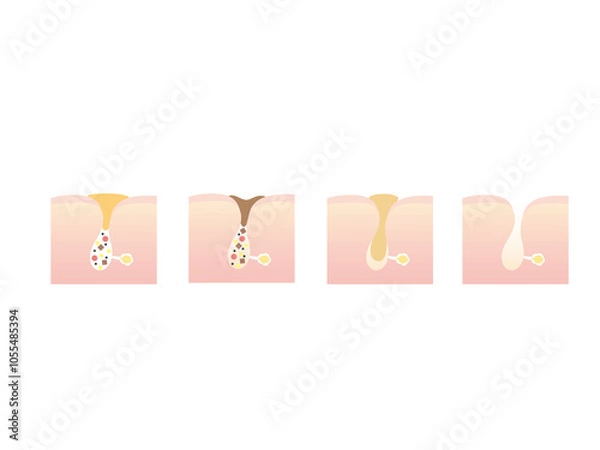 Obraz 毛穴汚れのイラスト