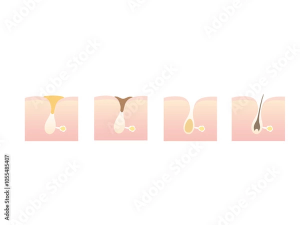 Obraz 毛穴のイラスト