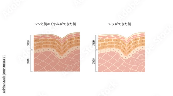 Obraz 図版_肌図版_016_シワとくすみ