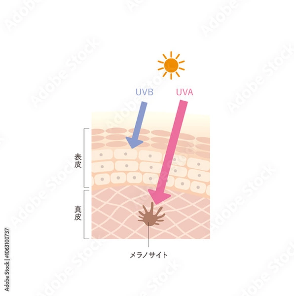 Obraz 図版_肌図版_017_紫外線の影響