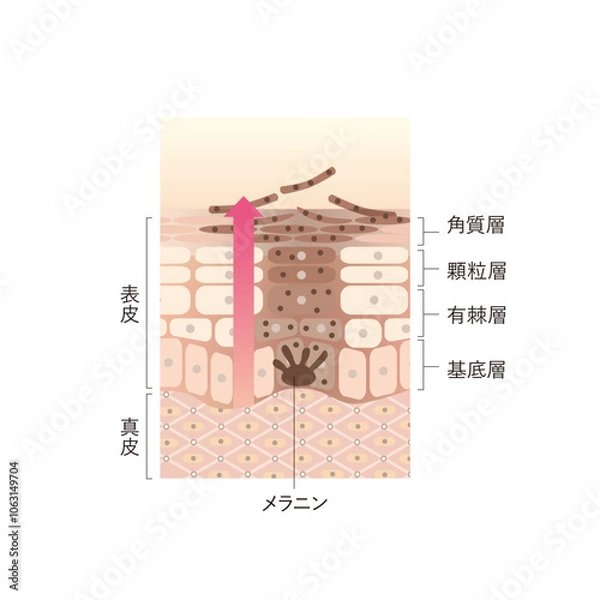 Obraz 図版_肌図版_028_シミのある肌のターンオーバー