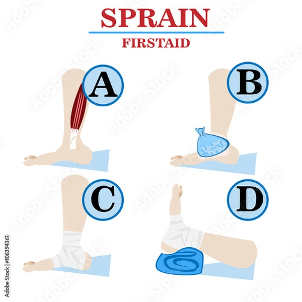 Fototapeta Sprain firstaid vector infographic image