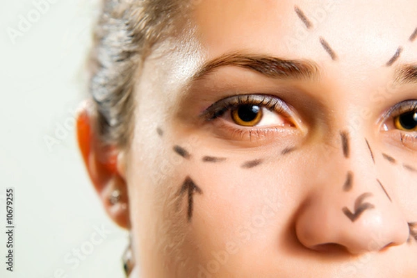 Obraz Facial plastic surgery