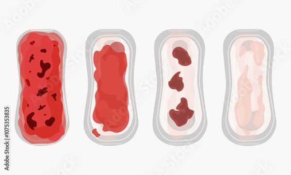 Obraz Vaginal postpartum bleeding - lochia. Lochia intensity scale on a set of sanitary pads. Isolates on a white background. Feminine hygiene. Women's health. Flat. Vector illustration.