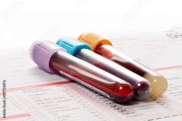 Fototapeta Blutuntersuchung, Blutproben auf einem Laborformular