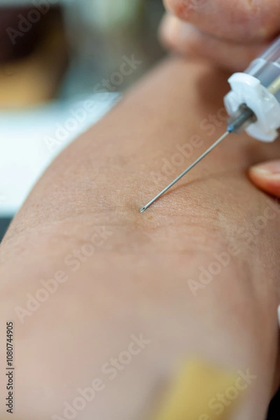 Fototapeta 採血の注射器と注射針