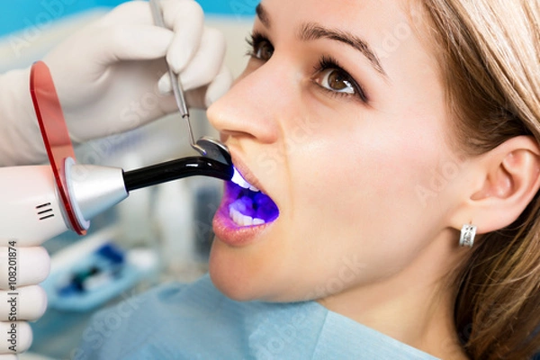 Fototapeta The reception was at the female dentist. Doctor examines the oral cavity on tooth decay. Caries protection. Tooth decay treatment. Dentist working with dental polymerization lamp in oral cavity