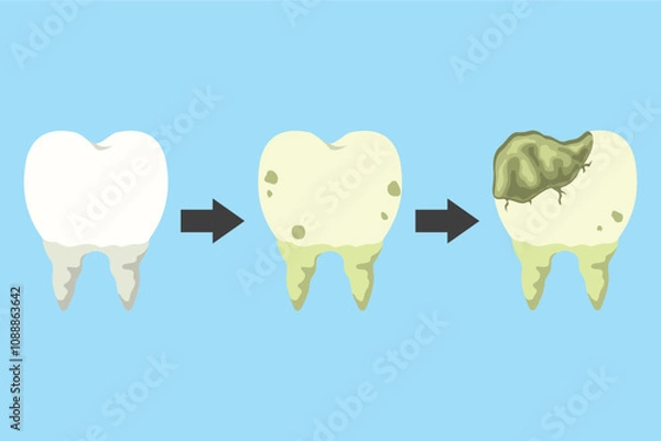 Obraz concept illustration of stages of tooth decay, flat style vector illustration.