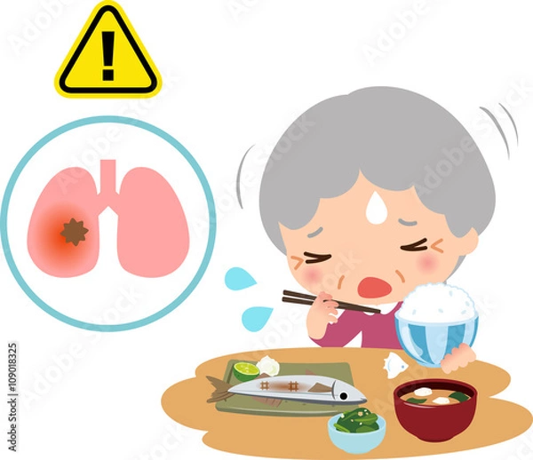 Fototapeta 食事中にむせるシニア女性と肺炎のイメージ