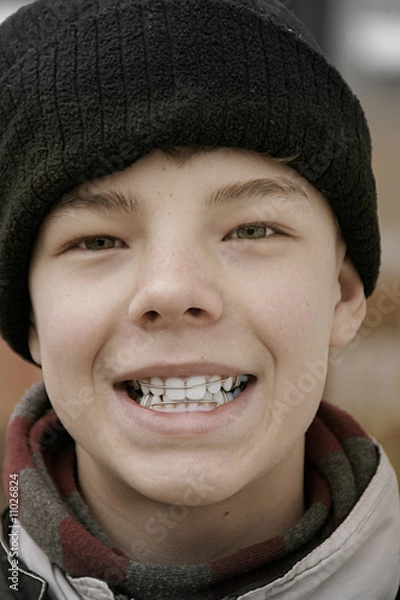 Obraz Junge mit Zahnspange