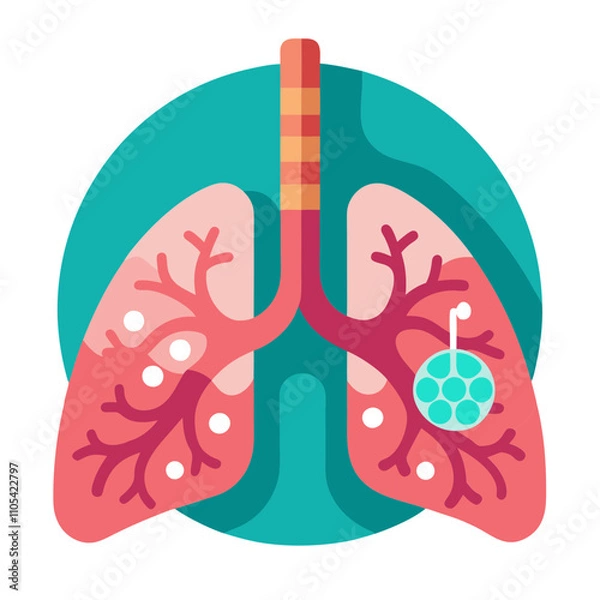 Obraz  Lung cancer