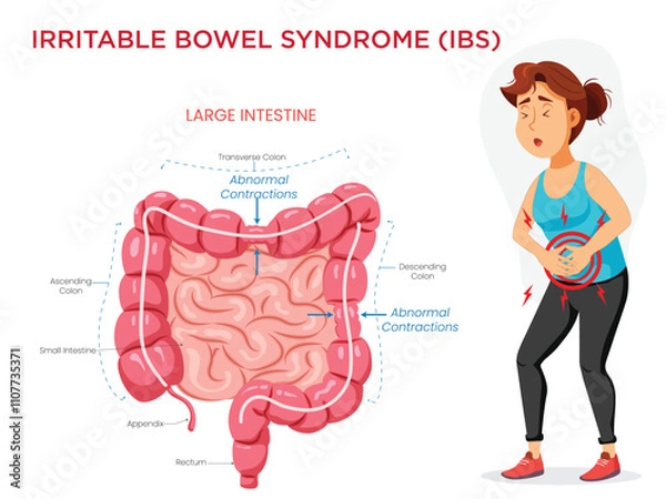 Fototapeta Irritable Bowel Syndrome Visualizing Symptoms with an Intestine Diagram