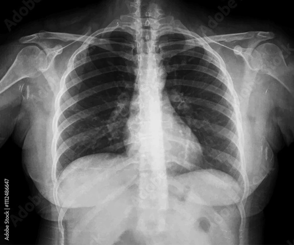 Fototapeta Upright Chest X-Ray for Medical Research and Teaching, vector illustration