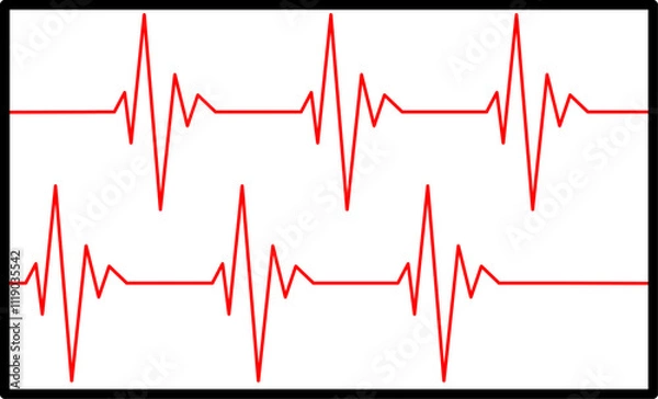 Obraz heart bit rate monitoring on white background, medical check heart with EKG, ECG tools measurement. result medical lab