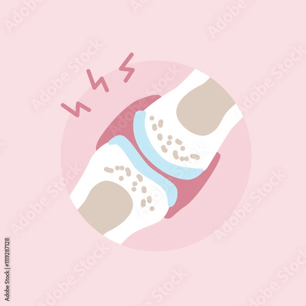 Obraz An inflamed joint in pain. Rheumatoid Arthritis. Vector illustration in flat style.