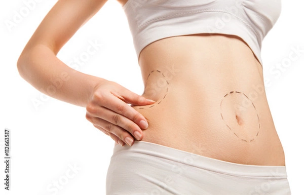 Fototapeta Patient with outlines on body in close-up