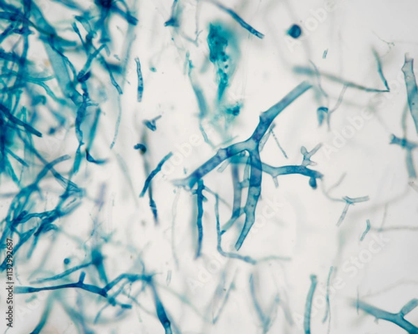 Fototapeta Mucor mucedo mycelium (plant pathogen) fixed slide viewed under the microscope at 400x.