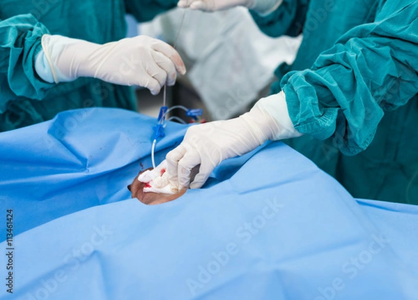 Obraz central venous pressure procedure