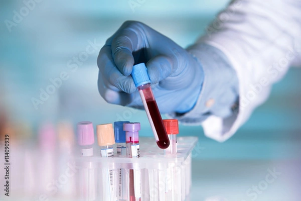 Fototapeta technik laboratoryjny trzymający próbkę krwi do badań / ręce technika laboratoryjnego z probówką z próbką krwi i statywem z innymi próbkami