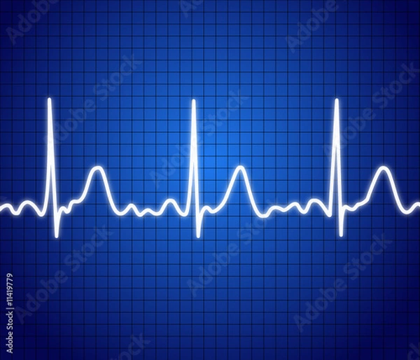 Obraz Illustration of electrical activity of the human