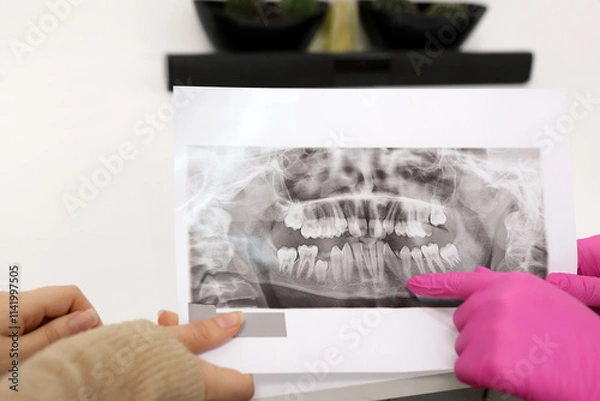 Fototapeta The dentist shows the patient an X-ray of the teeth, determines the method of treatment. The concept of dentistry.