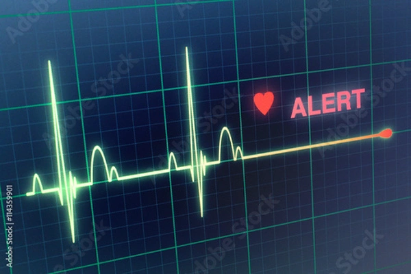 Fototapeta Heart beats cardiogram on the monitor.