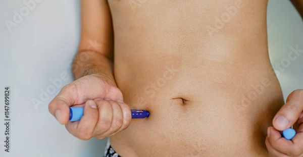 Fototapeta Close up of needle injecting insulin in abdomen.
