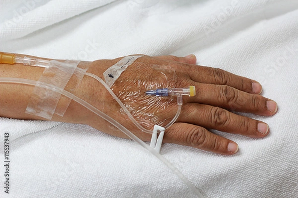 Obraz the intravenous fluid in a patient hand.