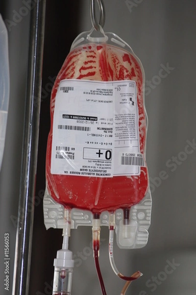 Obraz transfusion