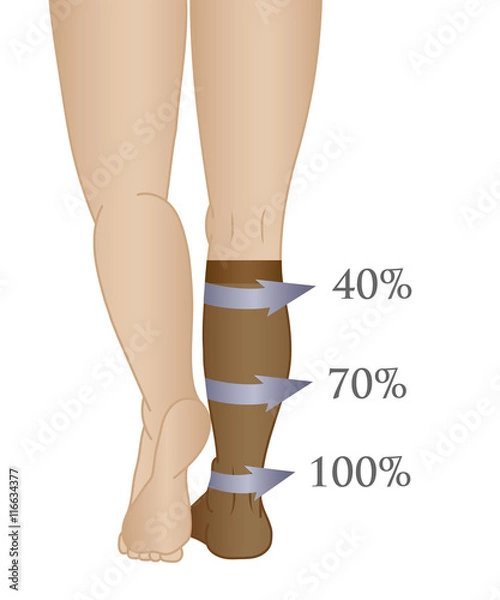 Obraz Medical compression hosiery