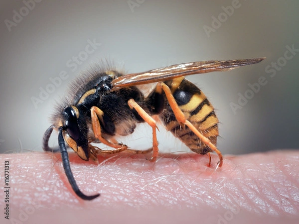 Obraz Wasp on a human hand. The sting of a wasp in the skin. Swelling, redness. macro