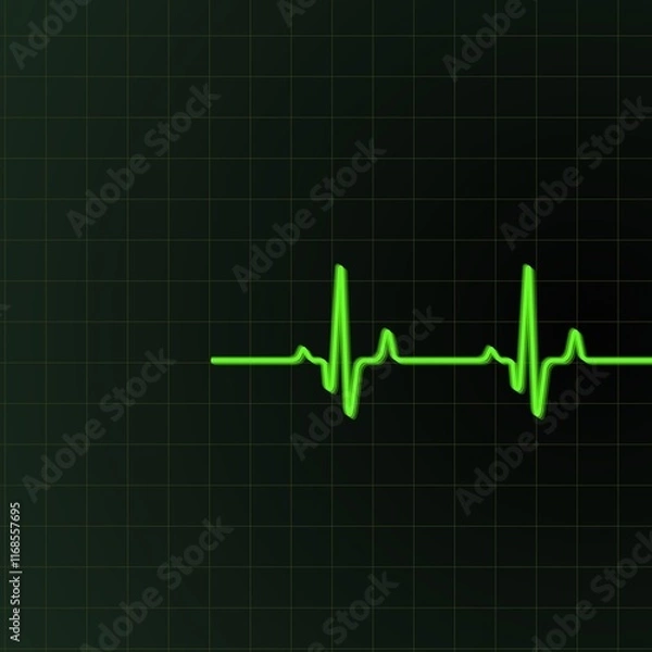 Fototapeta A green electrocardiogram (ECG) line is displayed against a dark grid background, showing a typical heartbeat pattern. The peaks and troughs illustrate the rhythm of the heart.