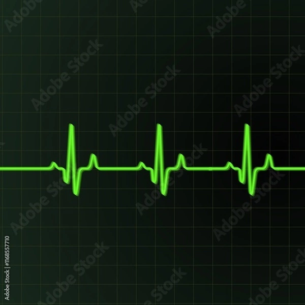 Fototapeta A green electrocardiogram trace runs across a dark grid background, depicting regular heartbeats. The line features sharp peaks and troughs, indicating the rhythm of a heartbeat.