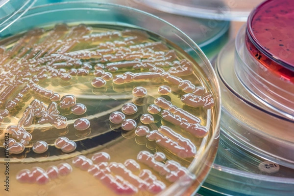 Fototapeta Bacterial colonies culture on MacConkey agar
