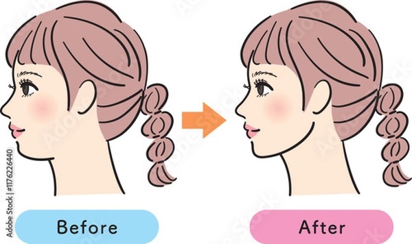 Obraz 二重あごの若い女性　ビフォーアフター