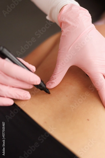 Fototapeta Close up of plastic surgeon using marker pen while marking body of fat woman in underwear before plastic surgery.